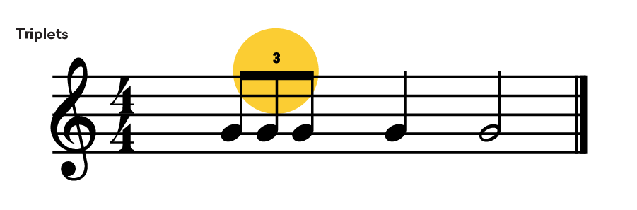 https://blog.landr.com/wp-content/uploads/2019/10/How-to-read-music_diagrams__Triplets.png